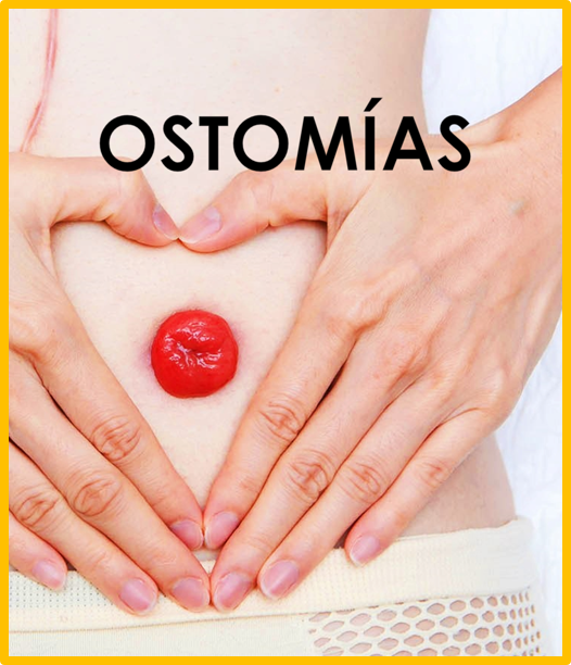 Curso 21: ver_04 - 2024 -  Curso Ostomias para profesionales de enfermería (08-10-2024 al 25-10-2024) 